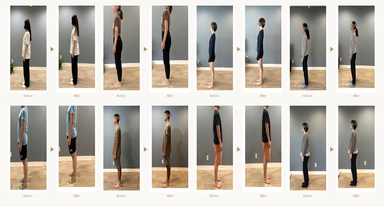 施術前後の姿勢変化