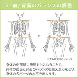Session 3: 側面のバランス